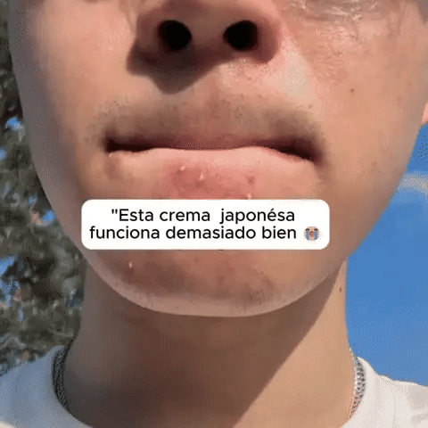 CREMA J4P0NESA IMPORTADO-ADIOS BARROS+ENVIO GRATIS