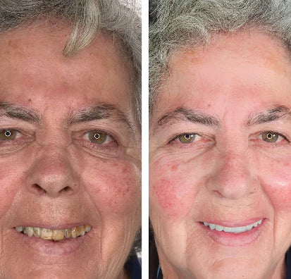 WhiteBalance Pro"-🌿 Refresca tu rutina, ilumina tu sonrisa+Envio gratis