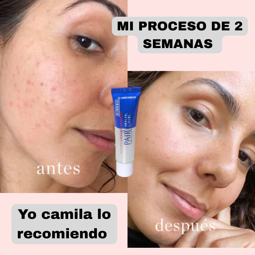 CREMA J4P0NESA IMPORTADO-ADIOS BARROS+ENVIO GRATIS