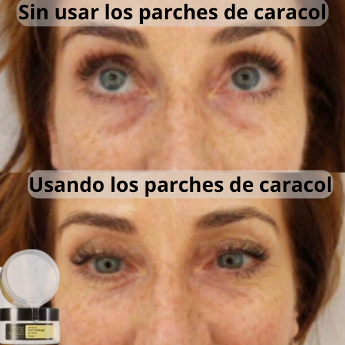 Parches de caracol con colágeno para quitar las 0jeras + Envío gratis