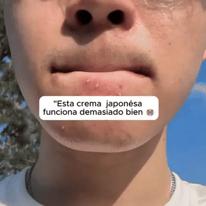 CREMA J4P0NESA IMPORTADO-ADIOS BARROS+ENVIO GRATIS